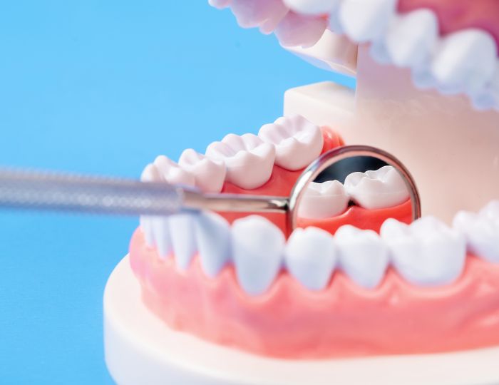 サイナスリフト法の仕組み